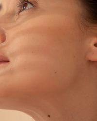 Hydrabalance Acne Safe Acne Best Clinic Los Angeles Black Owned Face Reality