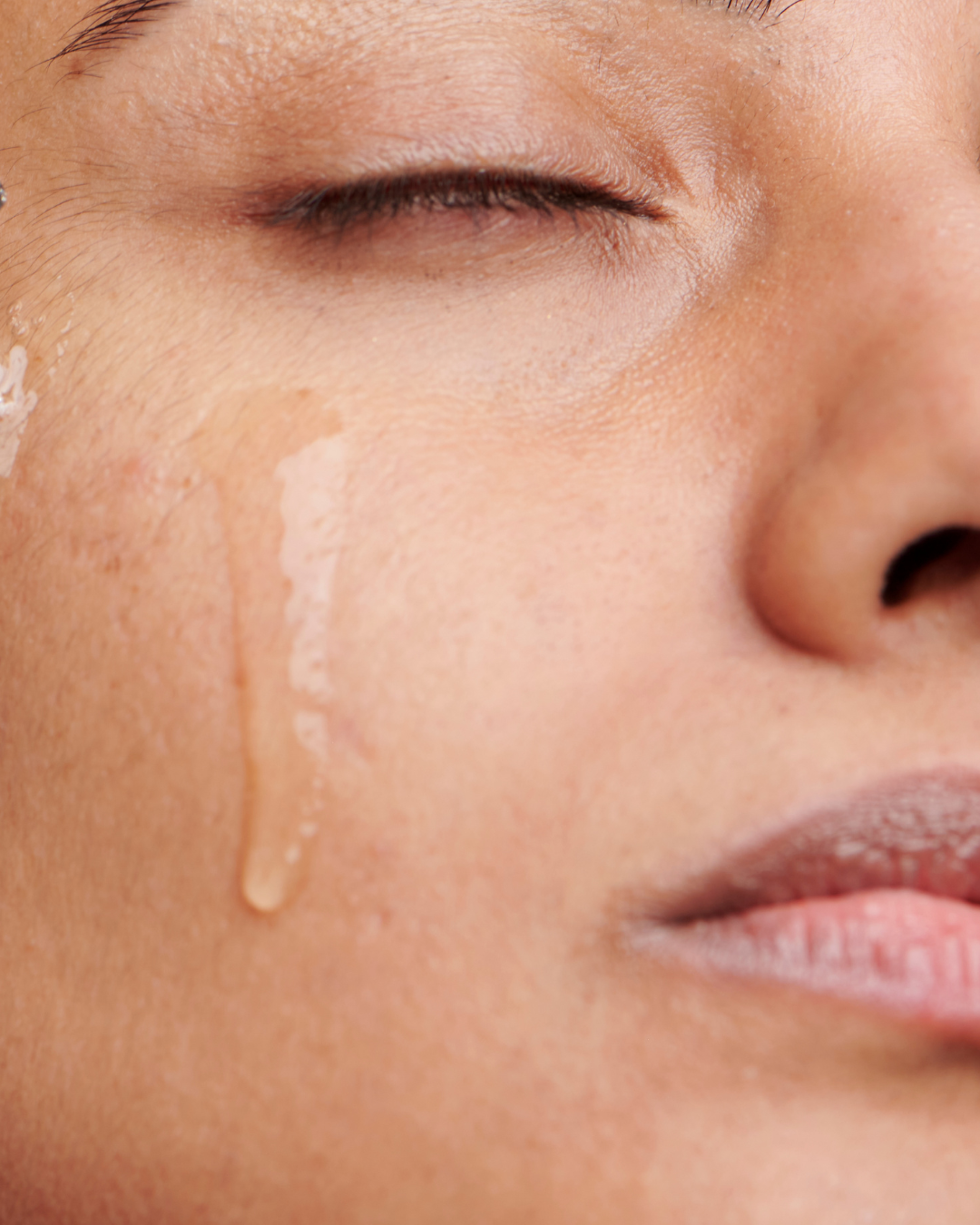 Mandelic Serum