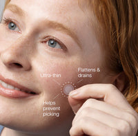 Acne Patches Face Reality