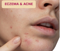 HYPOCHLOROUS ACID WIPES FOR SKIN & FACE - 75 CT